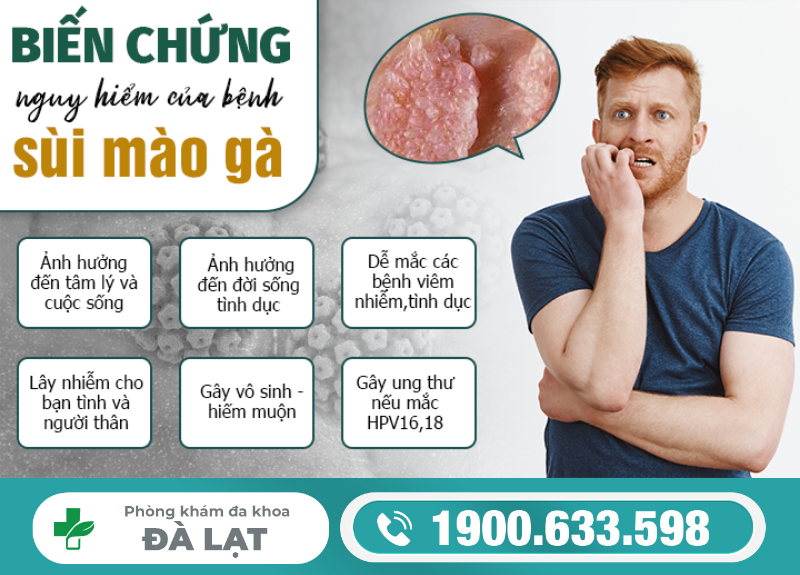 Hình ảnh minh họa